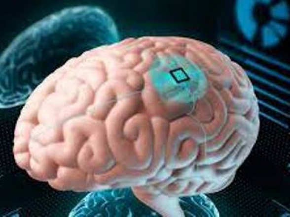 Իլոն Մասկի Neuralink-ը միկրոչիպեր կտեղադրի մարդկանց գանգերի մեջ և կստիպի ռոբոտներին ուղեղի վիրահատություն կատարել